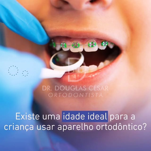 Conteúdo educativo sobre idade ideal para a criança usar aparelho ortodôntico